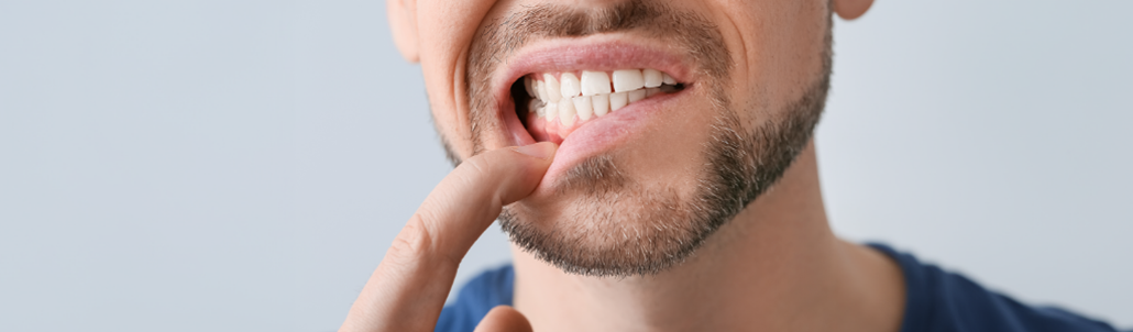 How to prevent dental caries